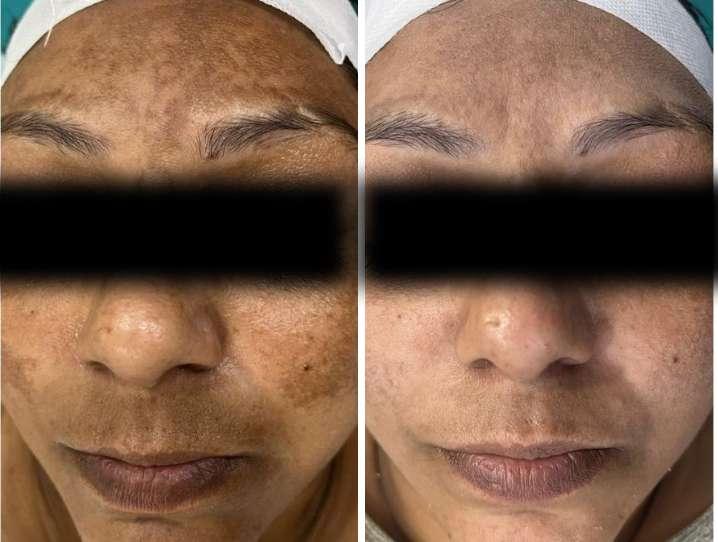 before-after