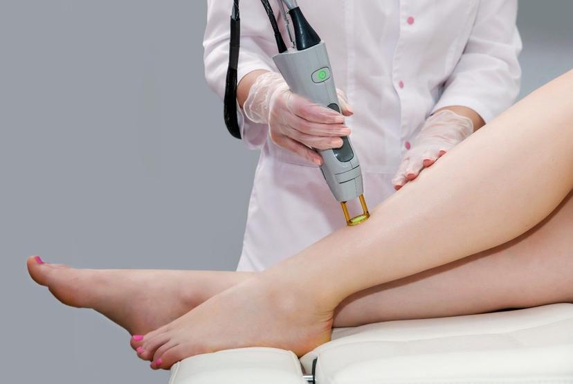 Planning To Go for a Laser Removal Session. Read About Its Side Effects