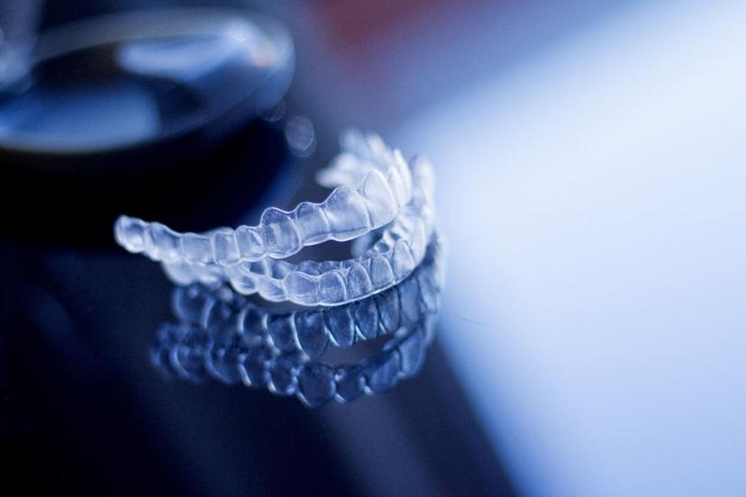 3 Reasons to Choose Clear Aligners Over Lingual Braces