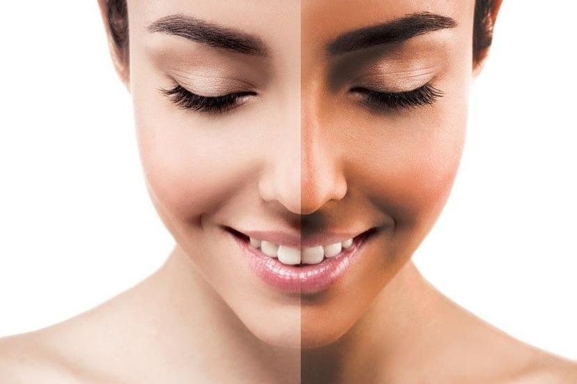 A Detailed Guide On How To Remove Tan From Your Face