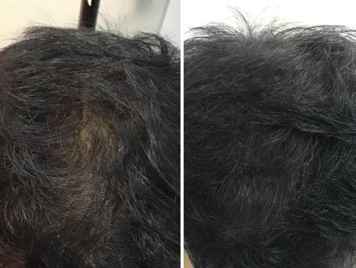 before-after