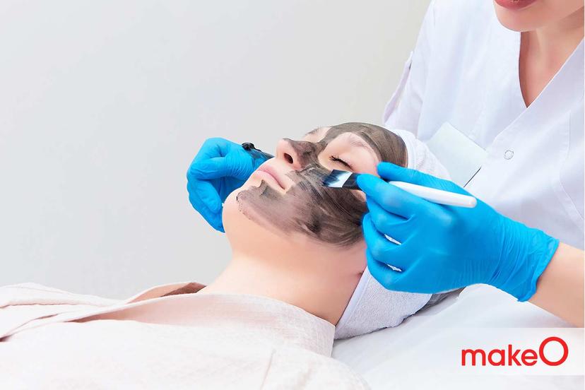 Carbon Laser Peels Vs Chemical Peels: Which One is Perfect for You?