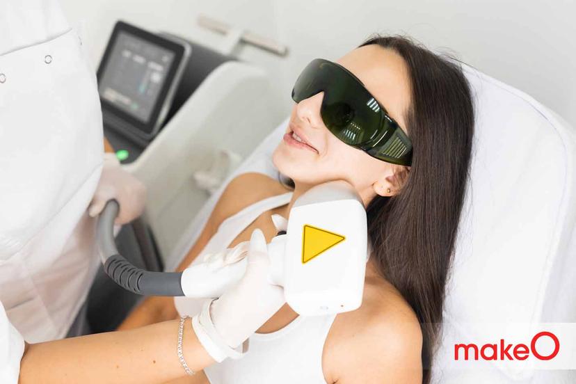 Laser Hair Removal for Hirsutism: Does it Work?