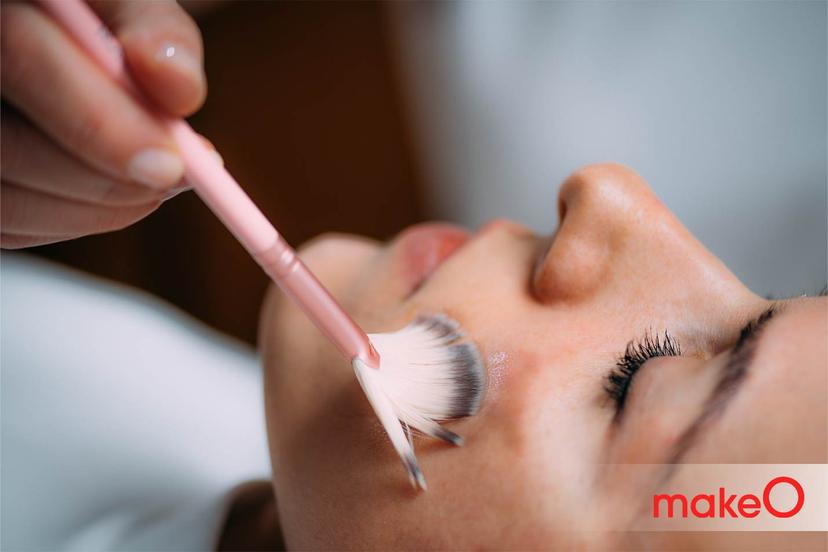 5 Easy Ways to Treat Acne-Related Hyperpigmentation 