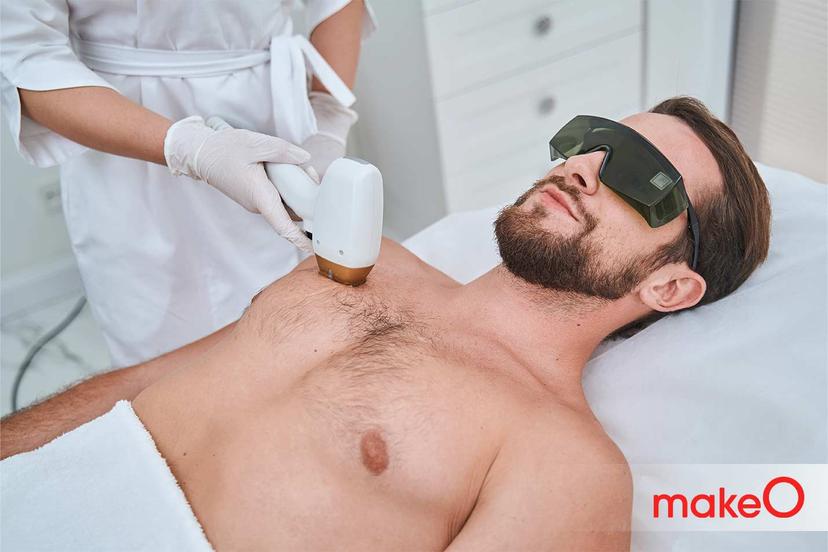 Razor Burns? Here’s why you should opt for alternative hair removal technique