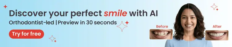 small banner mobile image