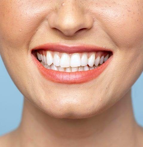 Teeth Straightening: Check Different Teeth Alignment Options