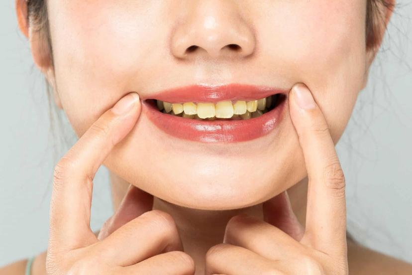 Yellow teeth: Know all about its causes and treatment