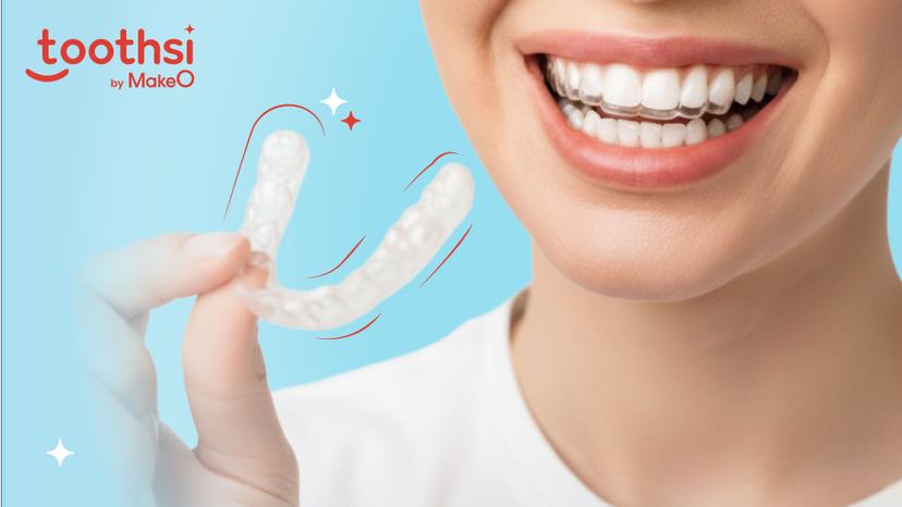 Retainer 101: What They Are, Why You Need One & What No One Tells You