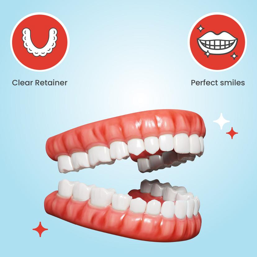 Teeth Retaiber Teeth Retainer 101: Purpose, Benefits & What to Expect