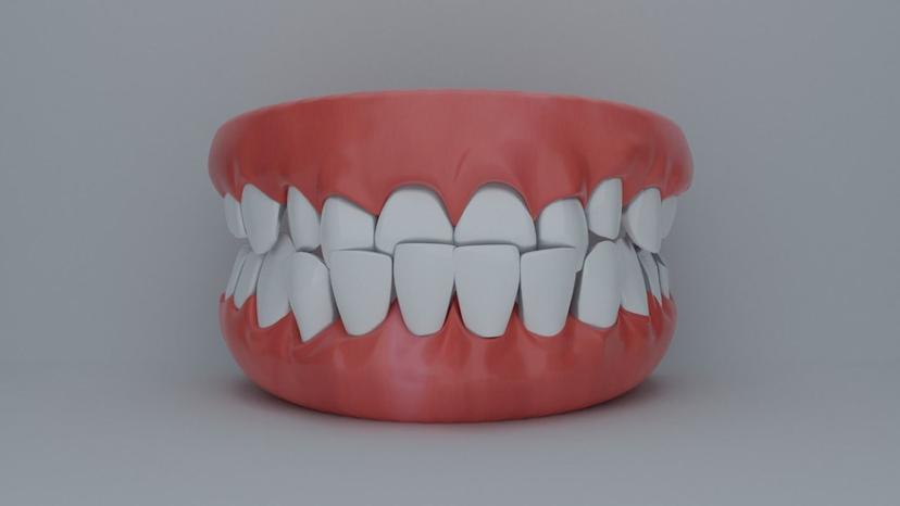Understanding Overbite and Overjet: Key Differences Explained