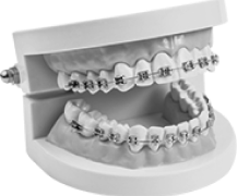 wired and metal braces for teeth
