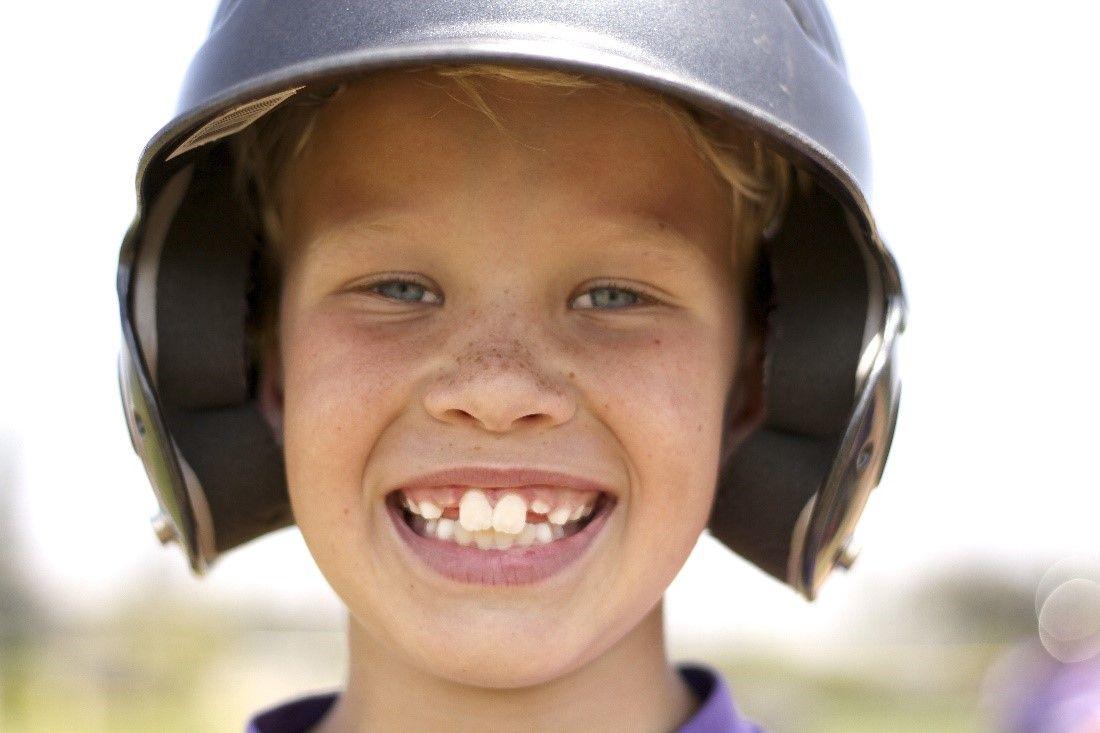 Milk teeth and Tips on  Dental Care