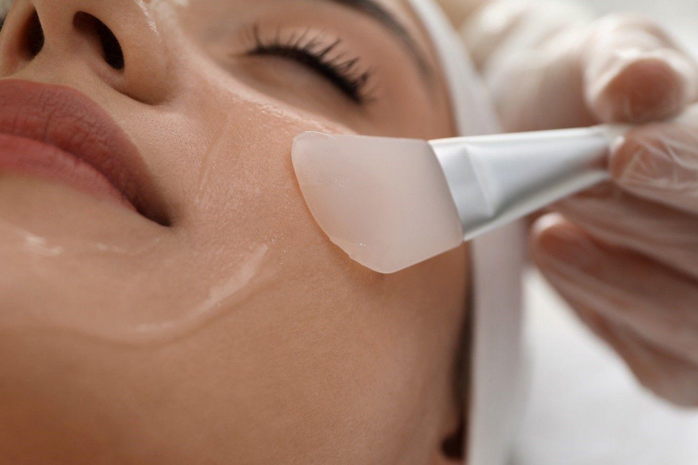 A Complete Guide to Chemical Peels - Treatments, Benefits Do's and Don'ts