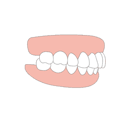 Eligibility Check for Clear Aligners | toothsi by makeO