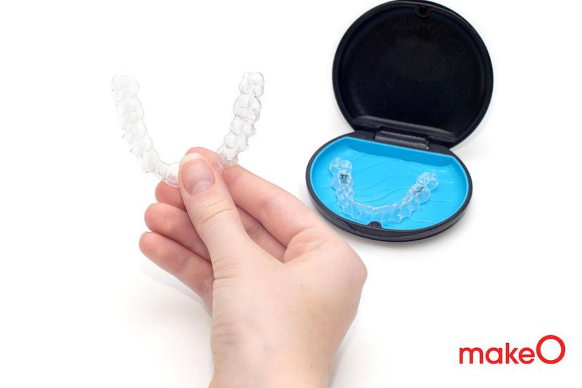 Can aligners fix a gummy smile? Causes, Treatments and More