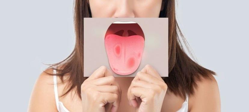 Canker sores 101: Everything you need to know