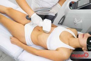 laser hair removal session