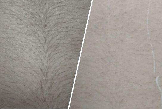 before-after