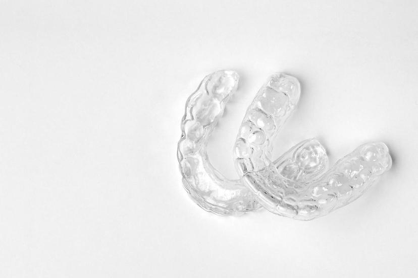 Metal Braces vs Transparent Braces. Know Everything Here