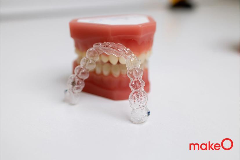 5 Reasons Why A Night Guard For Teeth Can Help You