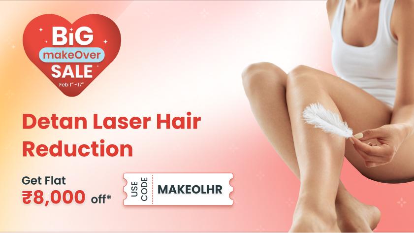 laser hair removal