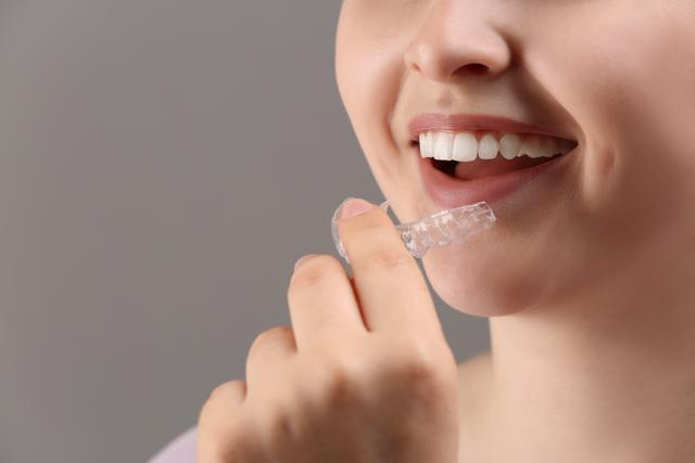 dos and donts of aligners