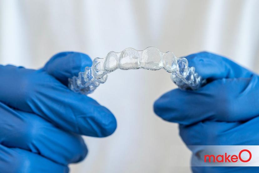 Is a Tooth Extraction Necessary When You Get Braces?