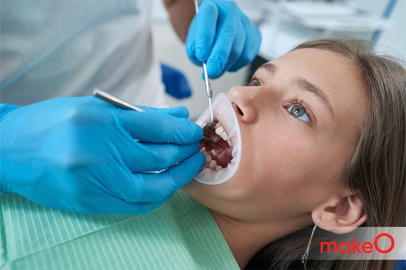 A Guide to White Gums: Causes, Symptoms and Treatment