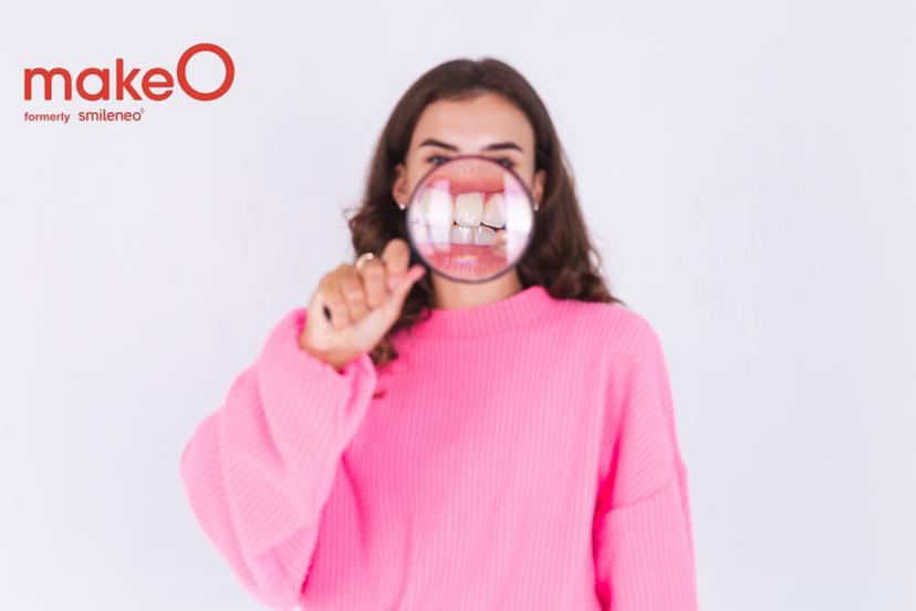 Why Do Teeth Shift Over Time? How to Keep Your Smile Aligned 