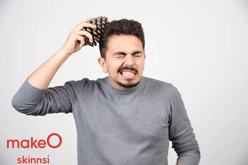 Syphilis Hair Loss: What Young Adults Need to Know